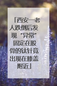西安一老人跌倒后发现“异常” 固定在股骨的钛针竟出现在膝盖附近